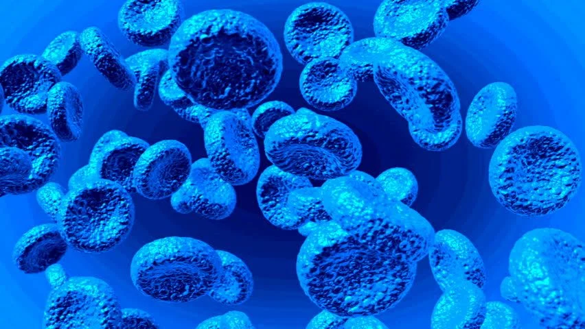 ANEMIA